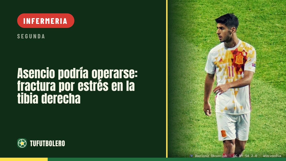 Asencio potrebbe finire in sala operatoria: frattura da stress alla tibia destra