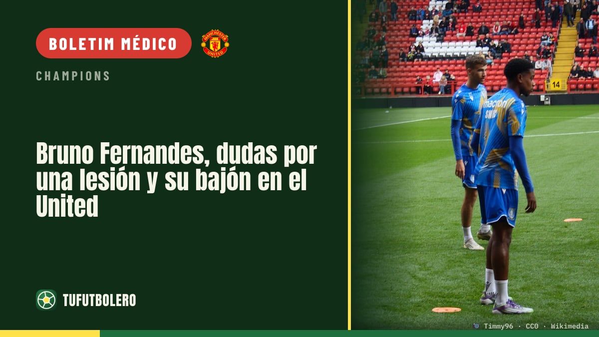 Bruno Fernandes tem dúvidas por lesão e quebra de forma no United