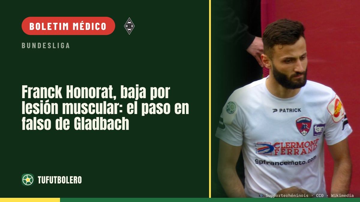 Franck Honorat fica de fora por lesão muscular e o Gladbach volta a tropeçar